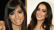 Anitta rinoplastia - Carol Soares/SBT; Graça Paes/ Brazil News