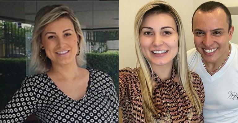 Andressa Urach: antes e depois - Instagram/Reprodução