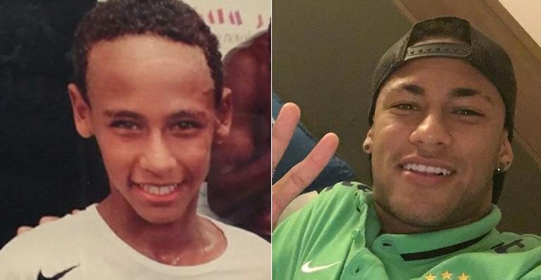 Lentes de contato no dente: conheça o procedimento realizado por Neymar - Reprodução / Instagram