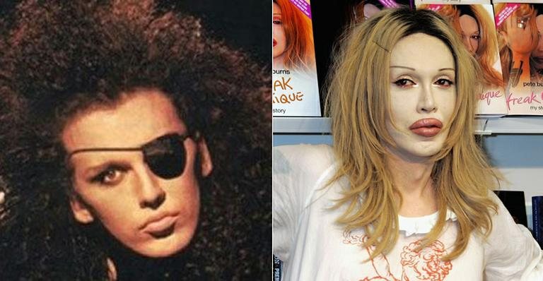 Pete Burns - Reprodução / Getty Images