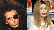 Pete Burns - Reprodução / Getty Images