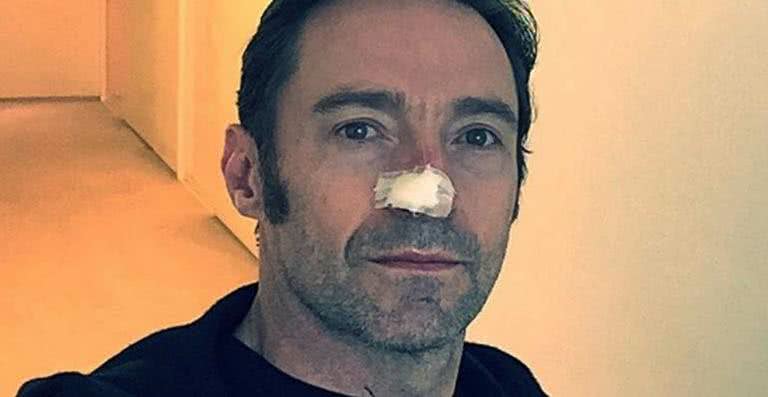 Hugh Jackman - Reprodução / Instagram