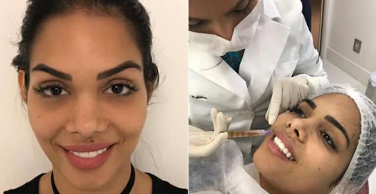 Aos 26 anos, ex-BBB Mayara faz tratamento estético para rejuvenescer - Black Empreendimentos/Divulgação