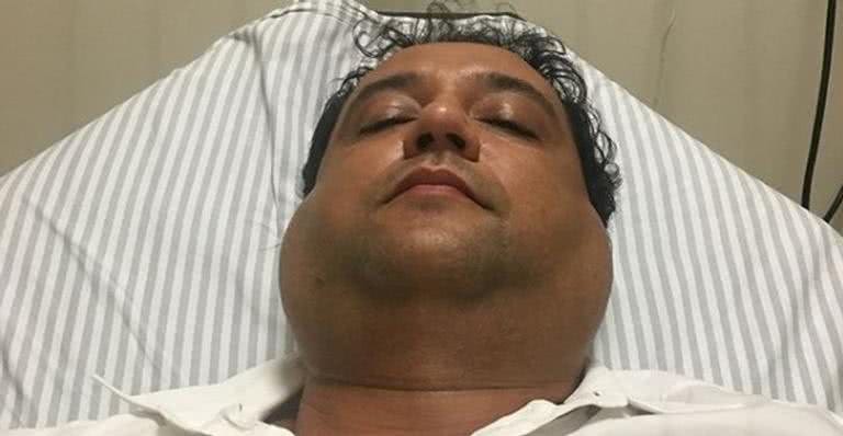 Geraldo Luis em hospital após ser diagnosticado com parotidite - Instagram/Reprodução