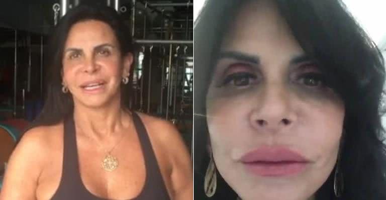 Gretchen faz novo preenchimento labial - Reprodução/Instagram