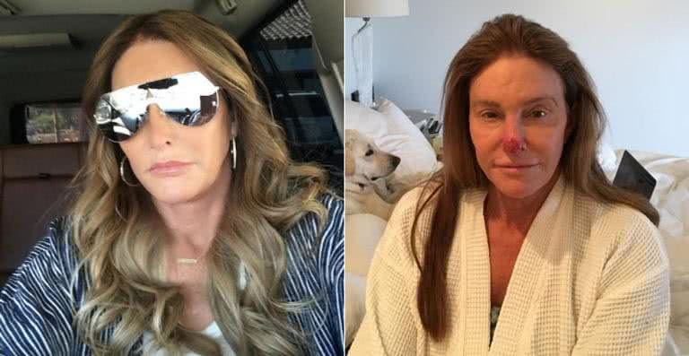 Caitlyn Jenner - Reprodução / Instagram