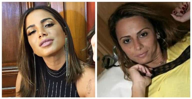 Anitta e Viviane Araújo são duas famosas que removeram tatuagens - Reprodução/ Instagram