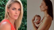 Sobrinho de Ana Hickmann nasce com lábio leoporino; entenda - Reprodução/Instagram