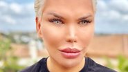 Rodrigo Alves - Reprodução/Instagram