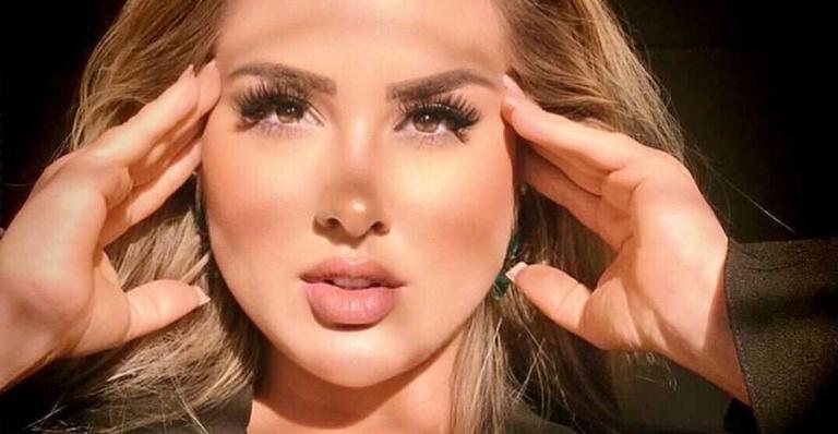 Ex-BBB surge com preenchimento labial renovado - Foto/Instagram