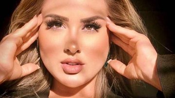 Ex-BBB surge com preenchimento labial renovado - Foto/Instagram