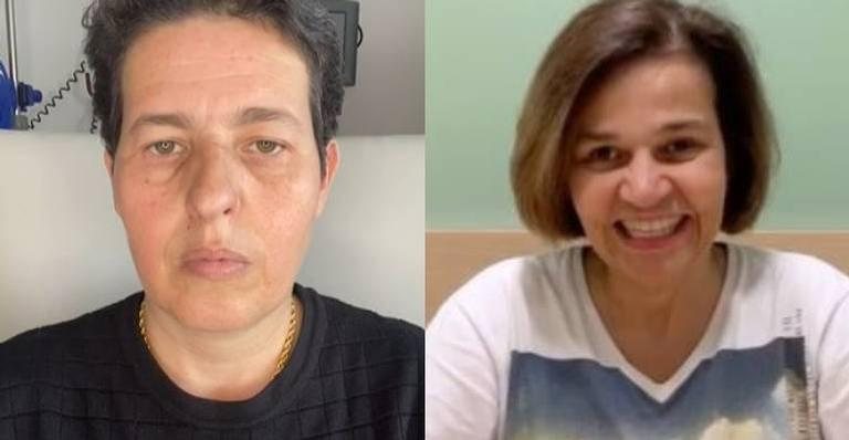 Claudia Rodrigues corre risco de ter surto de esclerose - Reprodução/Instagram