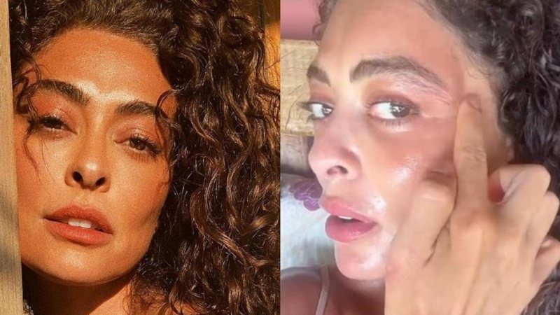 Juliana Paes é picada por inseto durante viagem para gravações de 'Pantanal' - Reprodução/Instagram