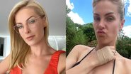 Ana Hickmann corta a mão ao colher frutas muito altas - Reprodução/Instagram