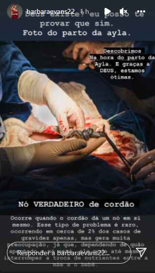 Bárbara Evans mostra nó no cordão umbilical no parto da filha