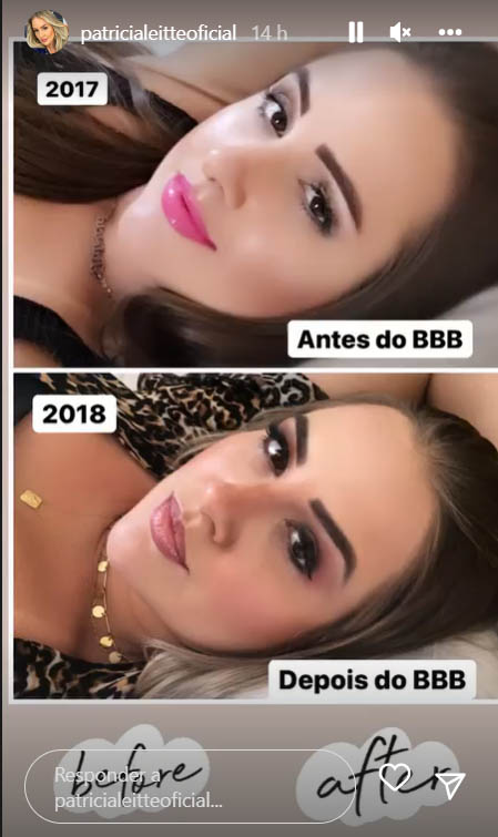 Patricia Leitte mostra fotos de antes e depois