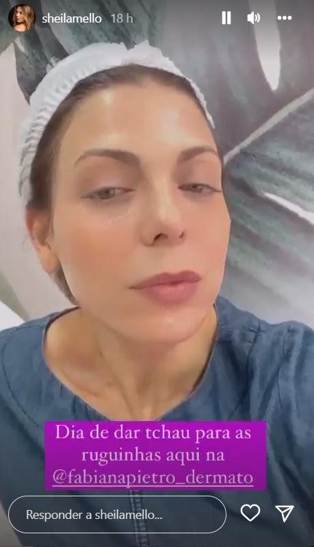 Sheila Mello mostra tratamento com botox