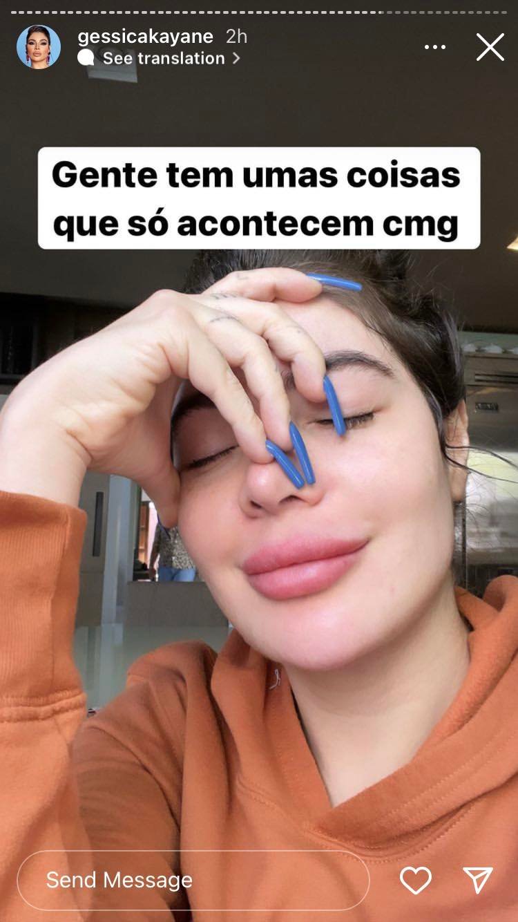 Gkay aparece banguela nos Stories e explica o que rolou