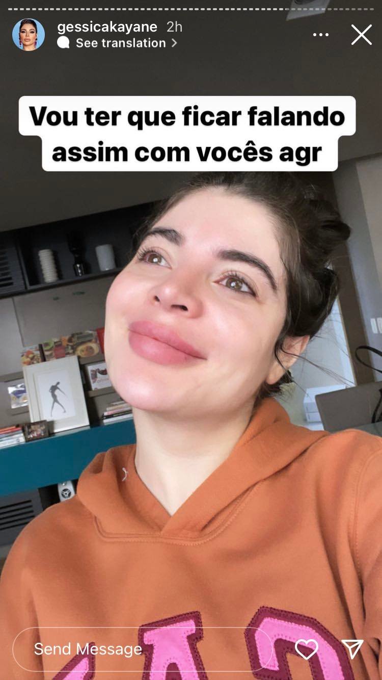 Gkay aparece banguela nos Stories e explica o que rolou