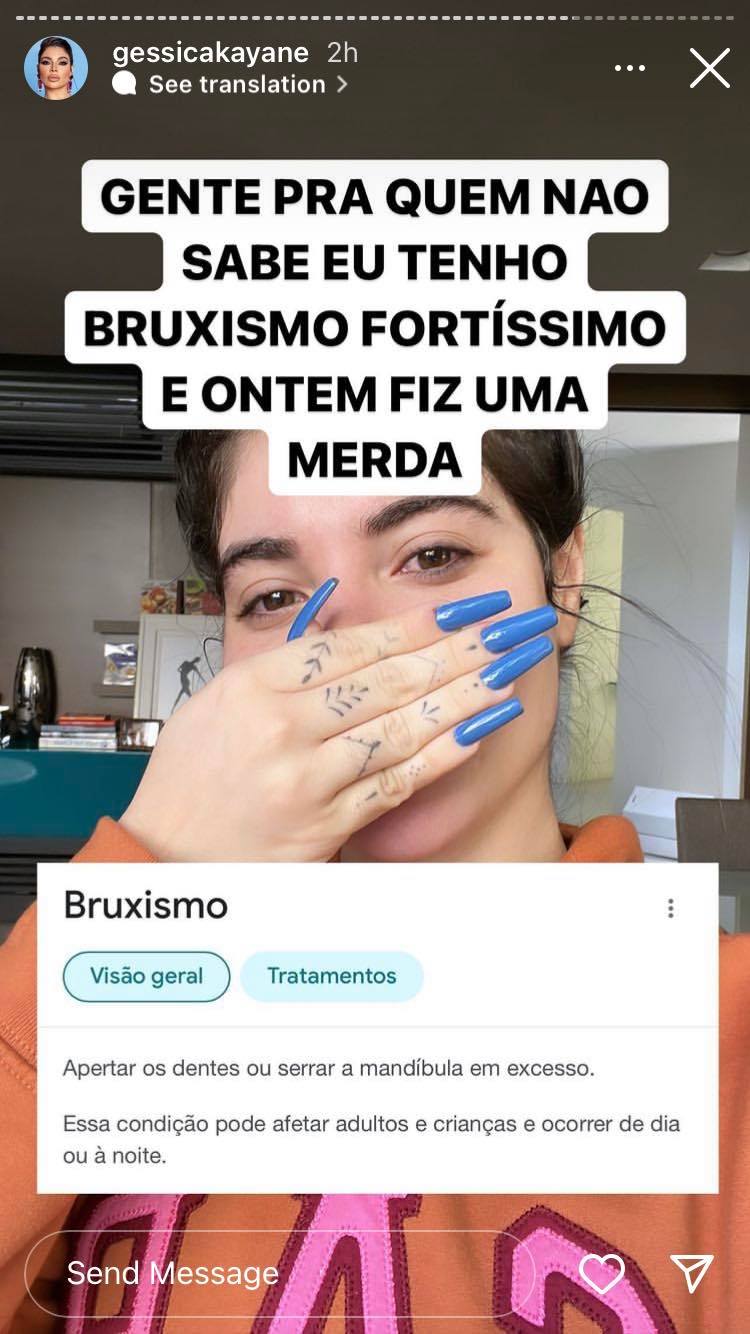 Gkay aparece banguela nos Stories e explica o que rolou