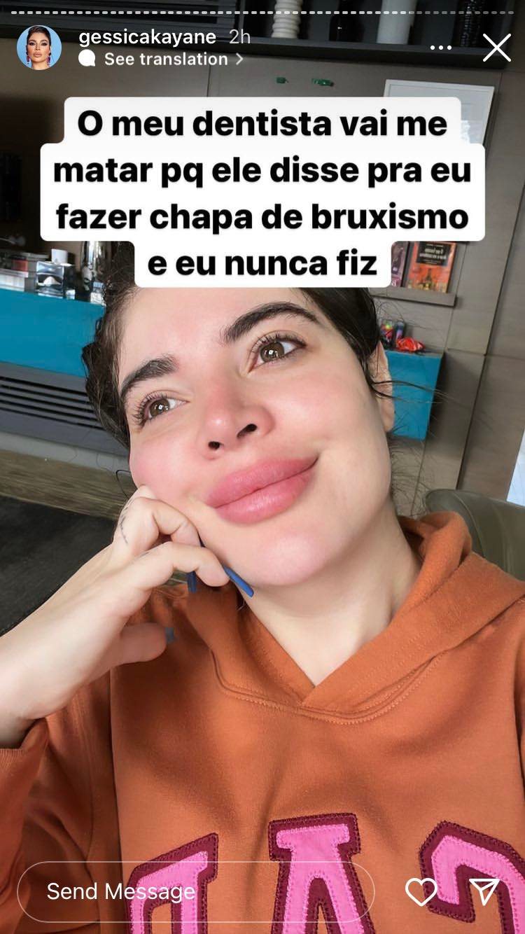 Gkay aparece banguela nos Stories e explica o que rolou