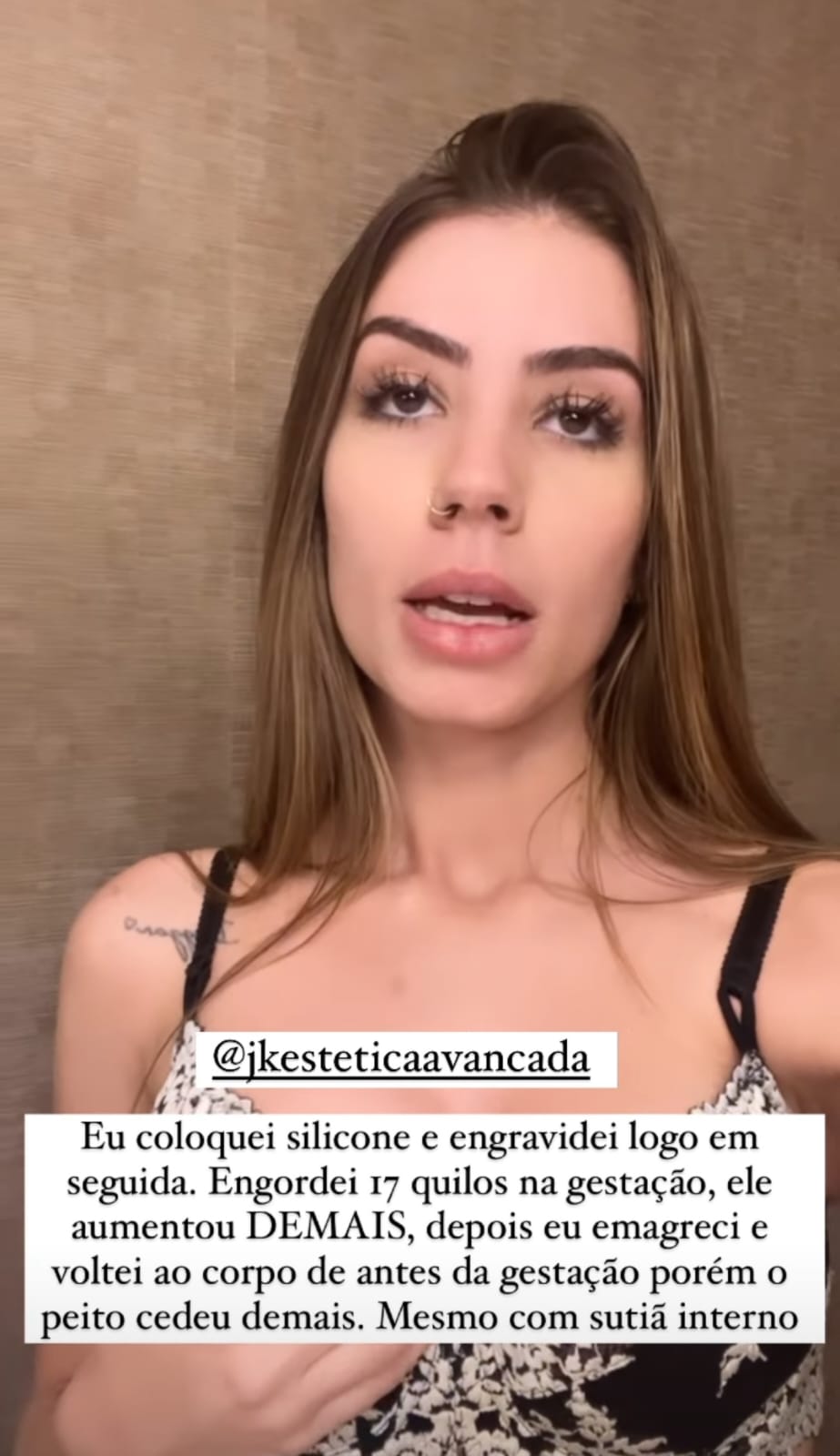 Maria Lina mostra antes e depois de cirurgia plástica nos seios - Instagram