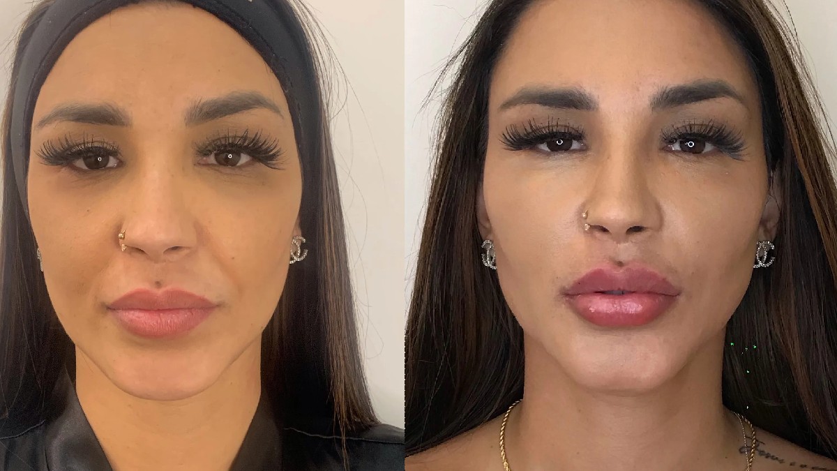 Antes e depois de Jenny Miranda