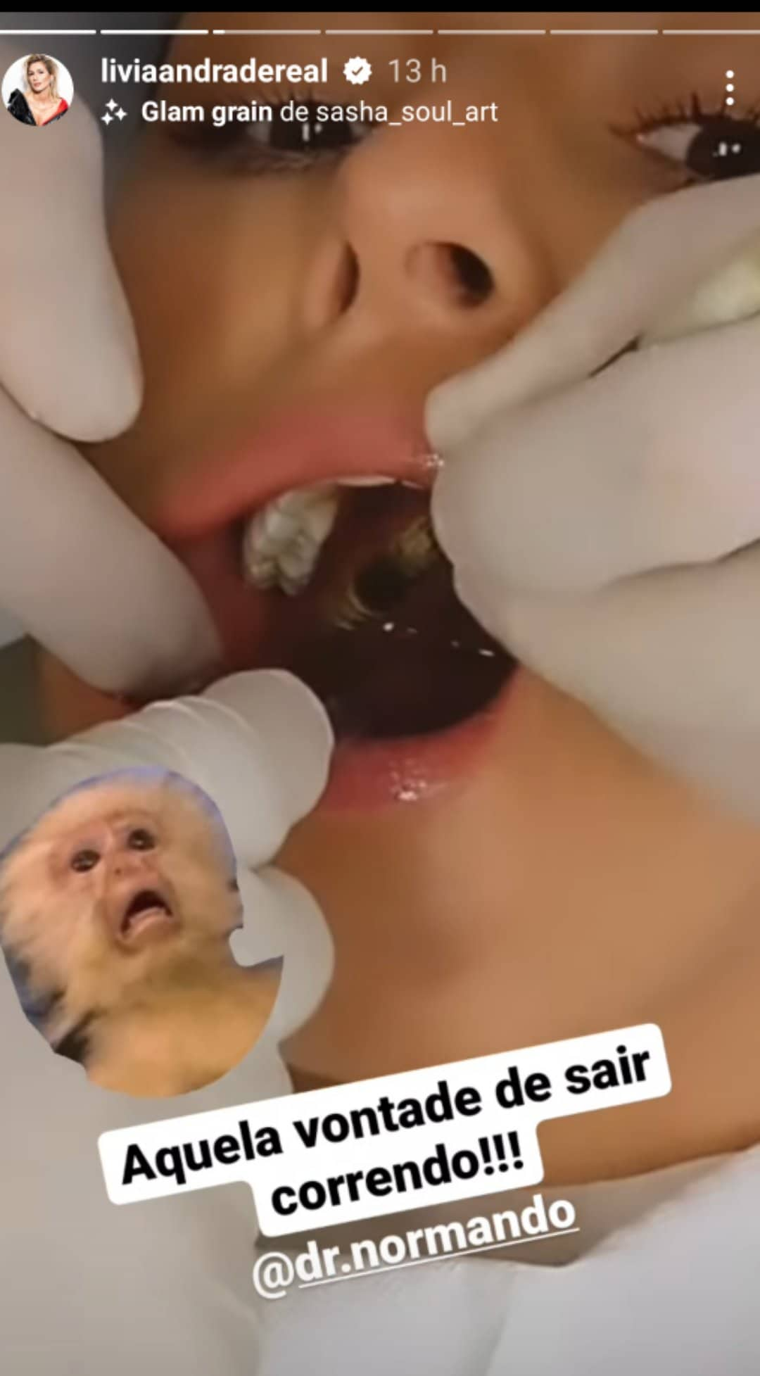 Lívia Andrade dentista