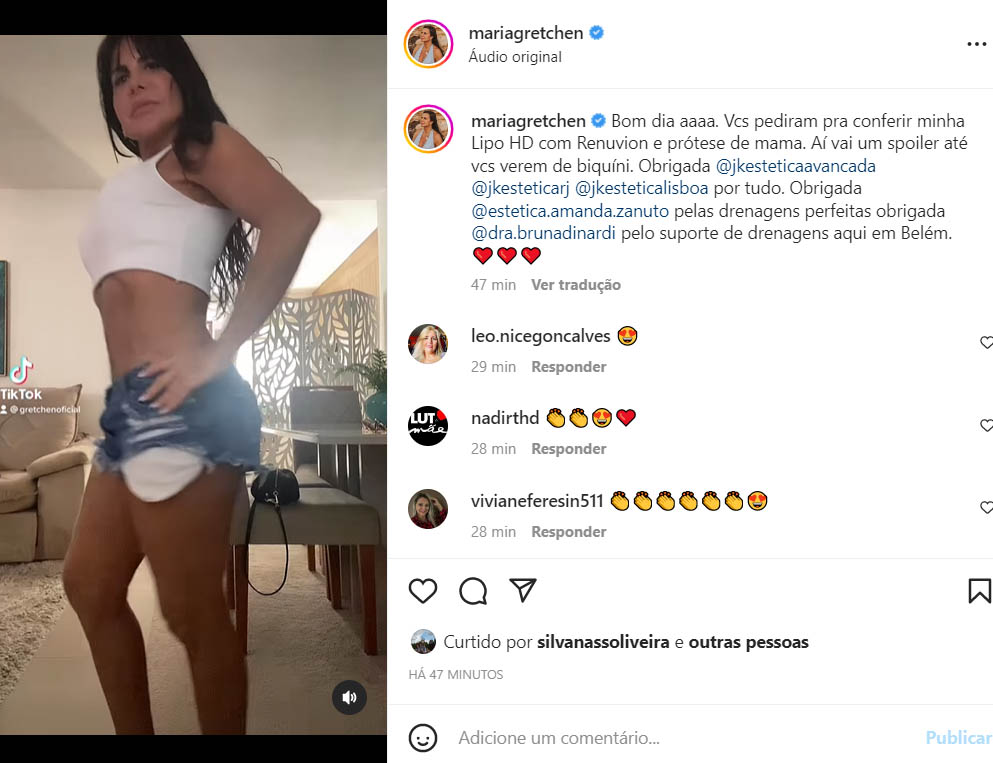 Gretchen mostra a barriga fazer lipo HD