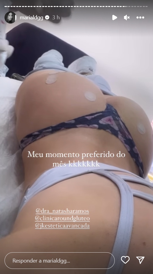 Maria Lina realiza procedimento estético no bumbum - Créditos: Reprodução / Instagram