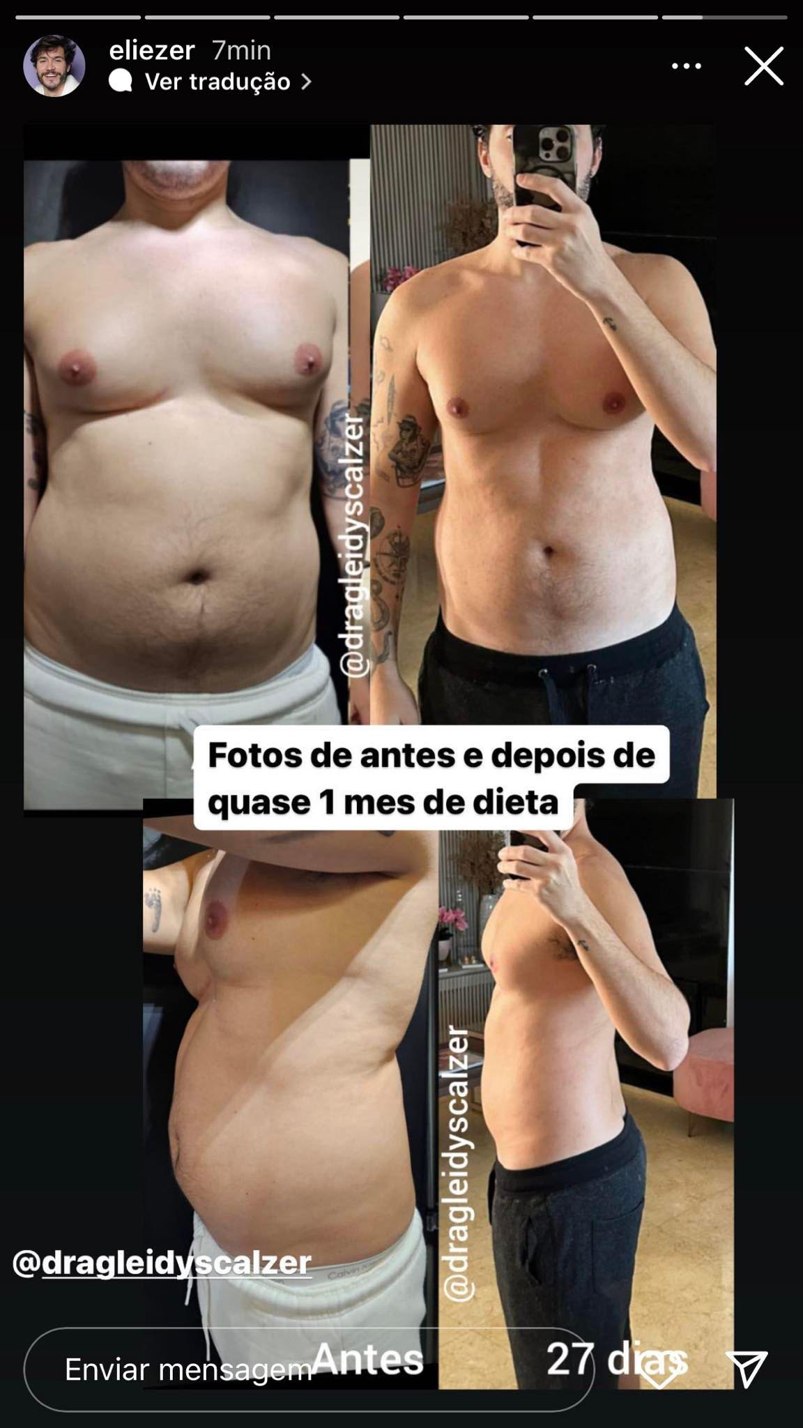 Ex-BBB Eliezer mostra fotos e depois do seu emagrecimento