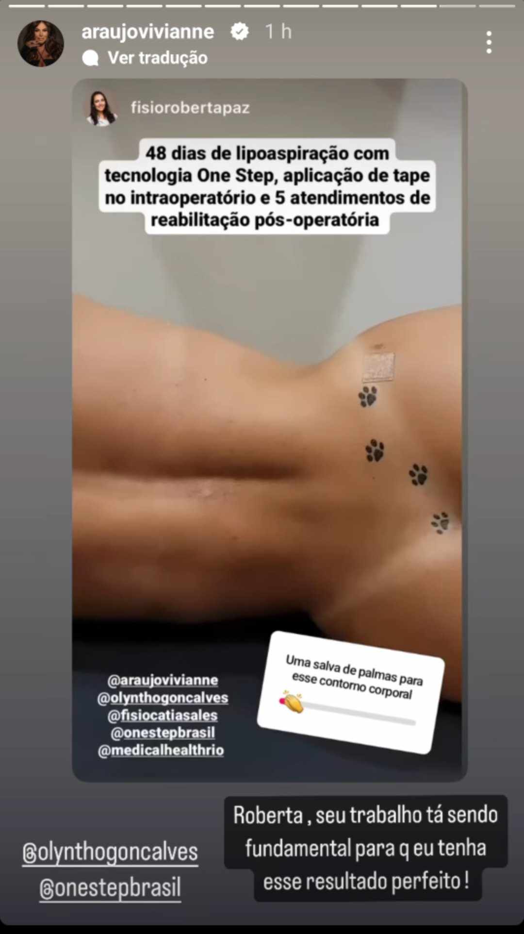 Viviane Araújo resultado lipoaspiração