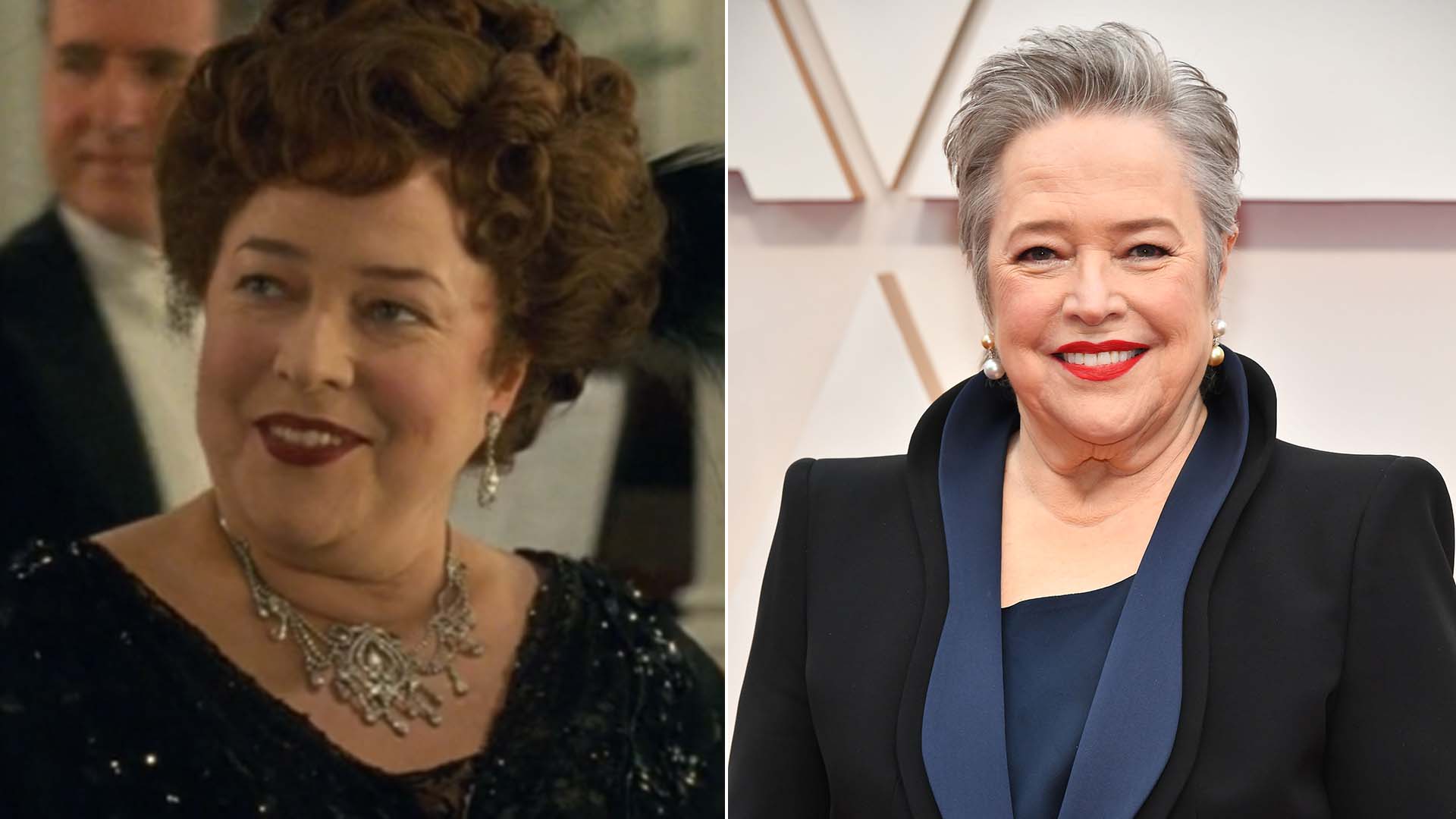 Antes e Depois de Kathy Bates - Fotos: Reprodução e Getty Images