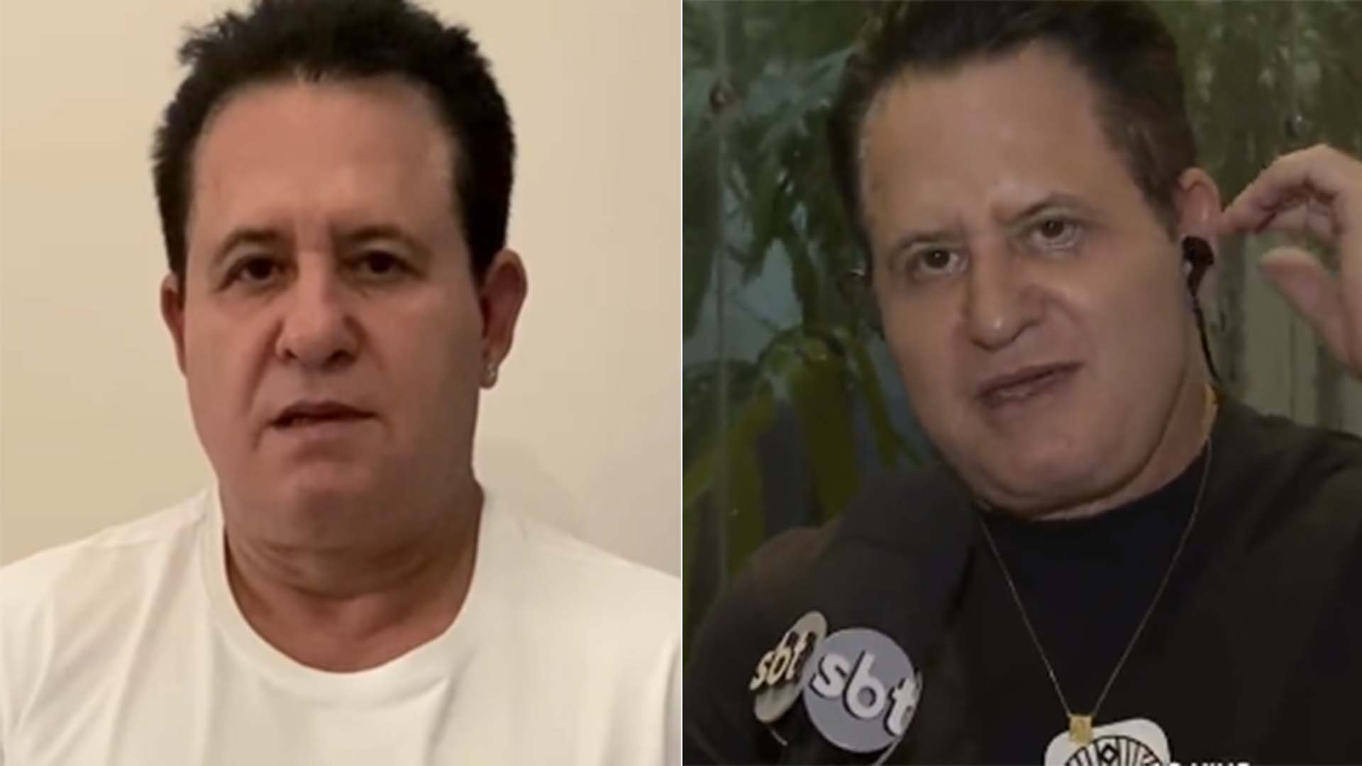 Antes e depois da cirurgia plástica de Marrone no rosto