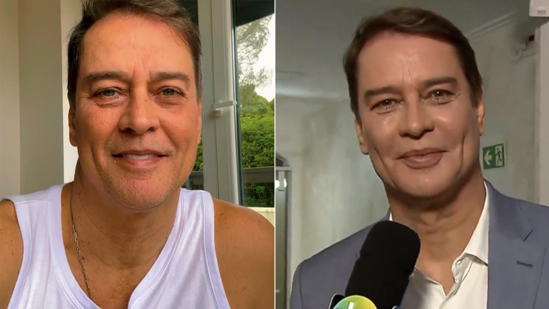 Antes e depois: Marcello Antony exibe o resultado da harmonização facial - Fotos: Reprodução / Instagram e SBT