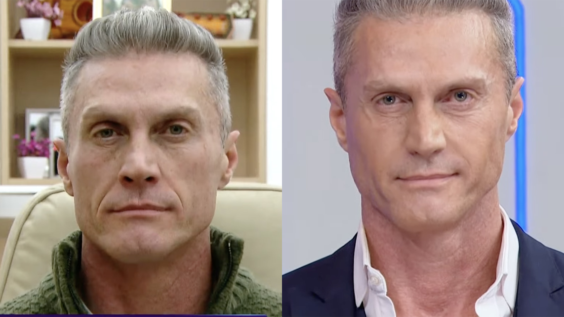 Antes e depois de André Segatti - Foto: Reprodução / SBT