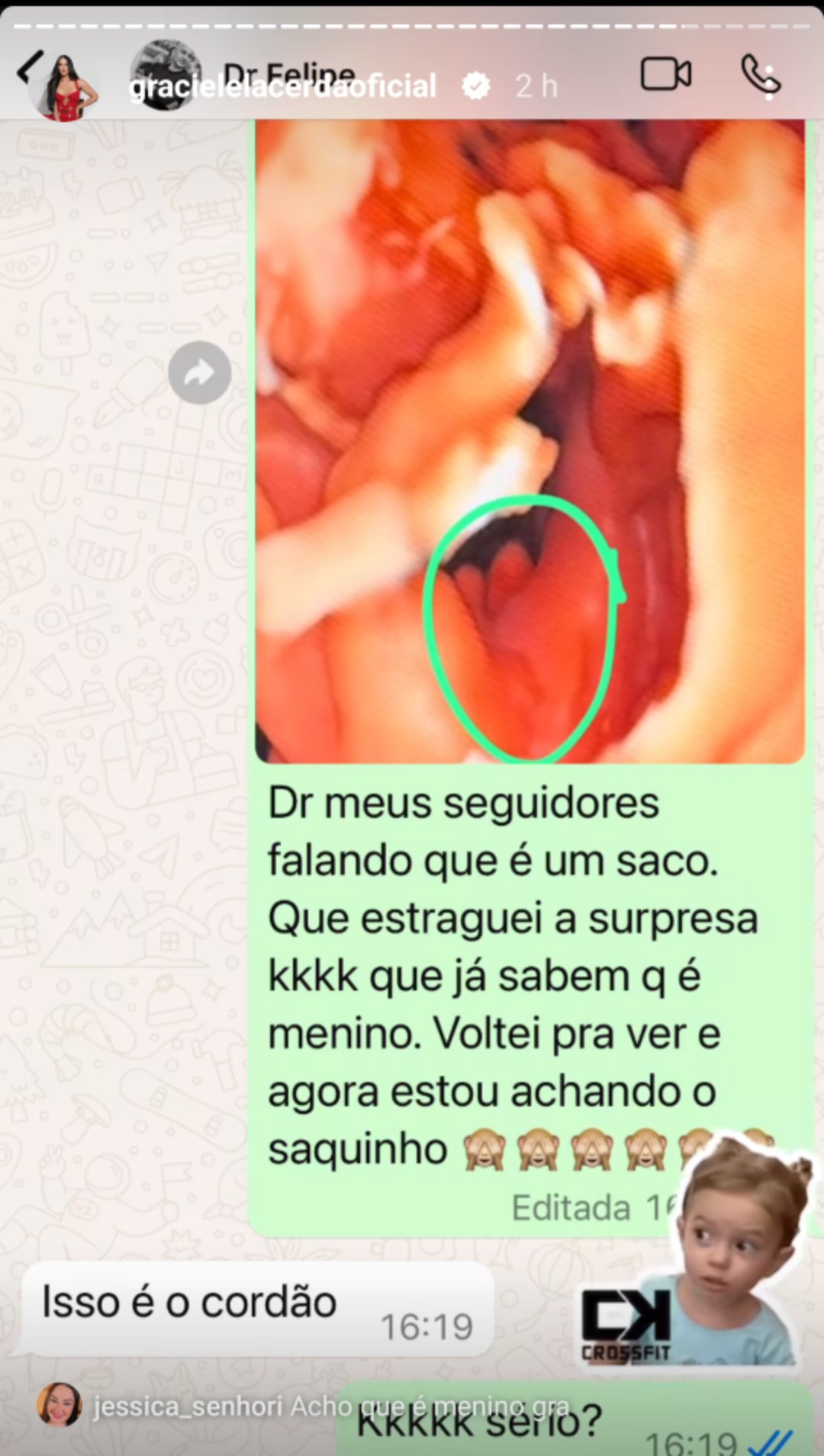 Graciele Lacerda se desespera ao mostrar ultrassom