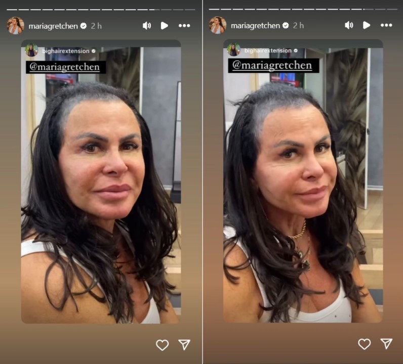 Gretchen explica uso de prótese capilar - Reprodução / Instagram