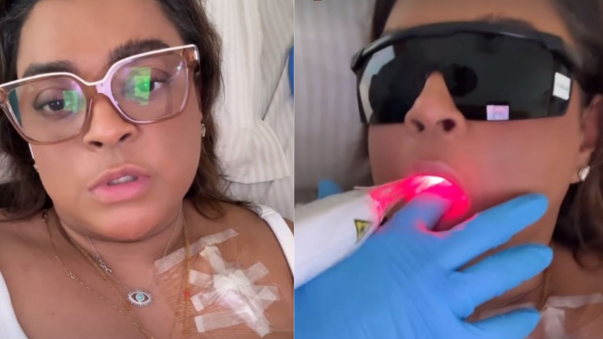 Preta Gil usa laser na boca para tratar mucosite