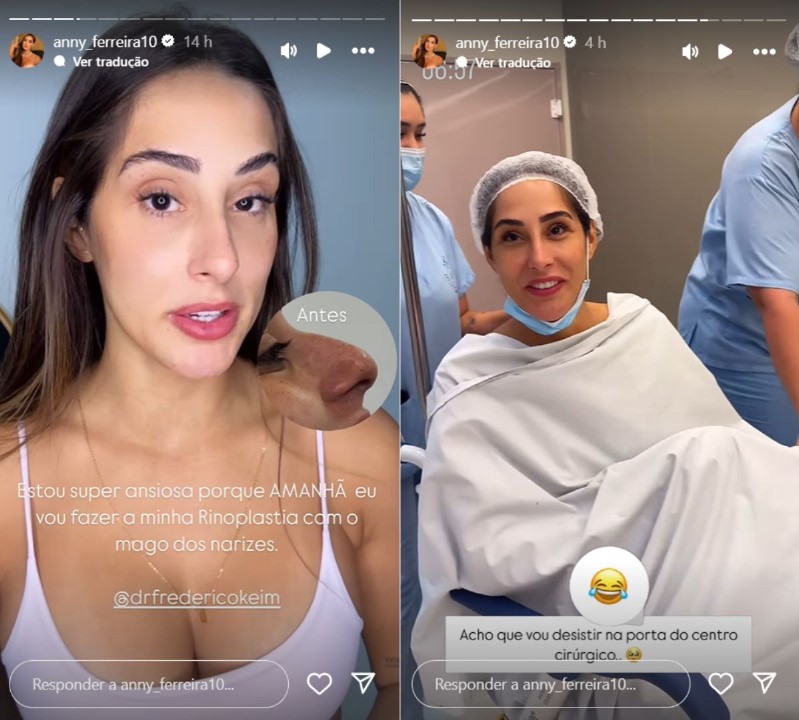 Ex-BBB Deniziane realiza nova cirurgia plástica - Reprodução / Instagram