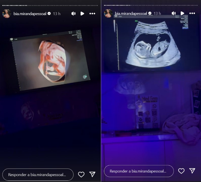 Bia Miranda mostra ultrassom da segunda gravidez - Reprodução / Instagram