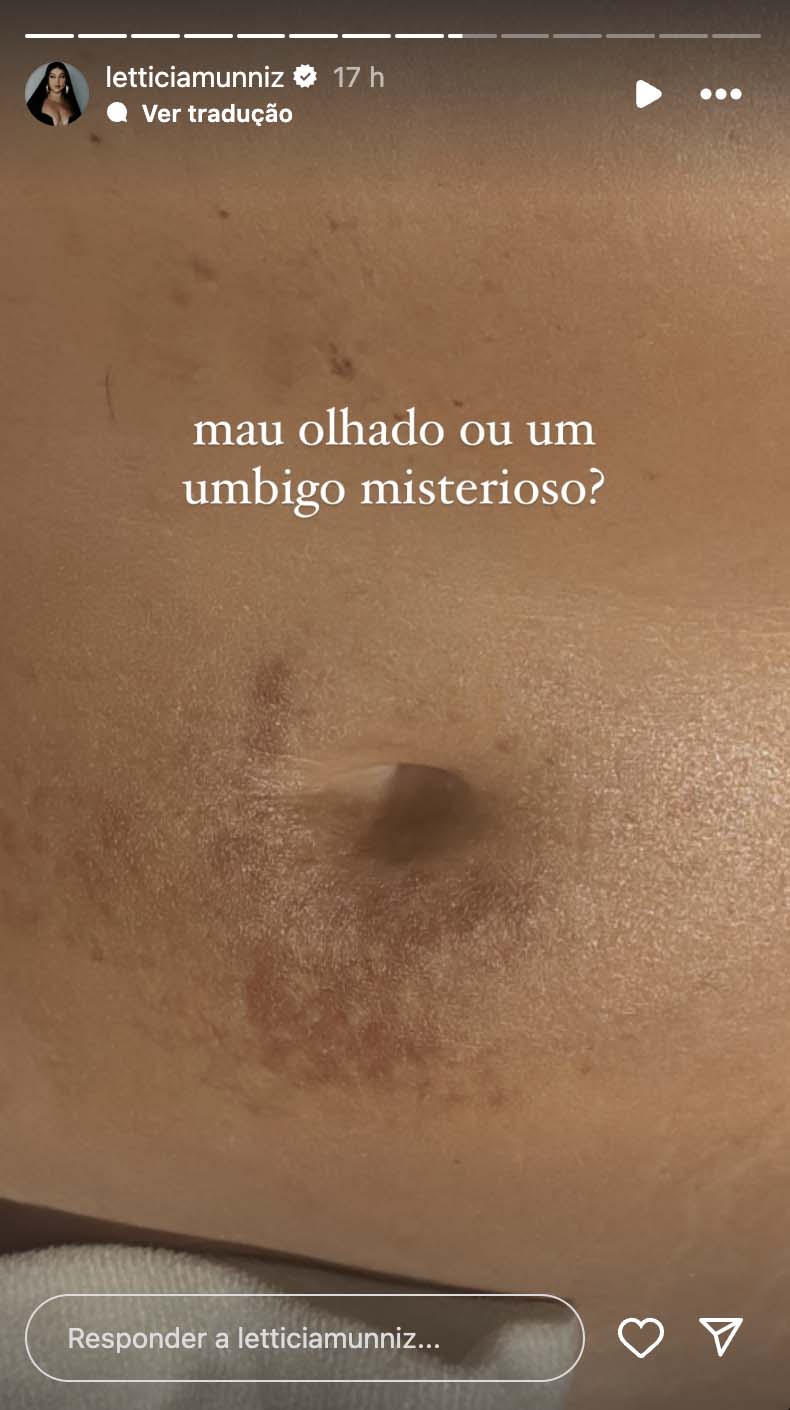 Umbigo de Letticia Munniz