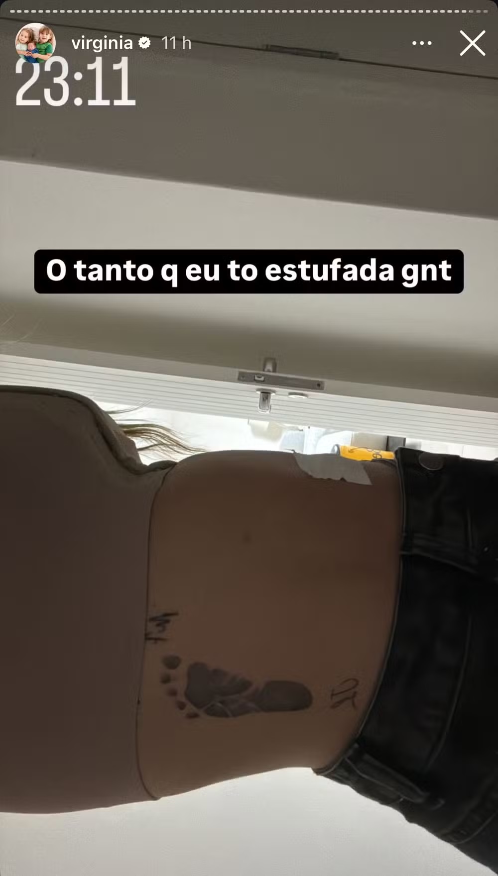 Virginia mostra barriga inchada após procedimentos (Reprodução/Instagram) 