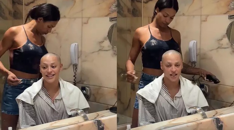 Médico alerta para doença de Pabllo Vittar: ‘Deve evitar esses gatilhos sempre que possível’