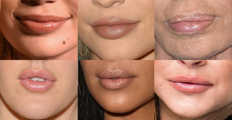 Veja como eram 15 celebridades antes do preenchimento labial!