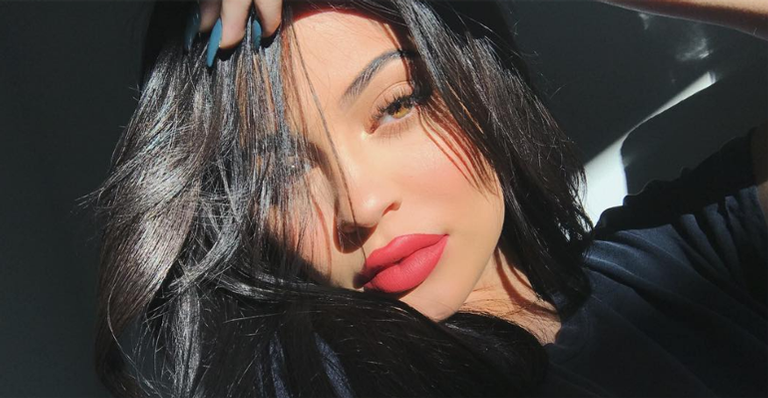 Kylie Jenner com preenchimento labial 