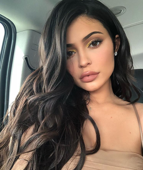 Kylie Jenner com preenchimento labial 