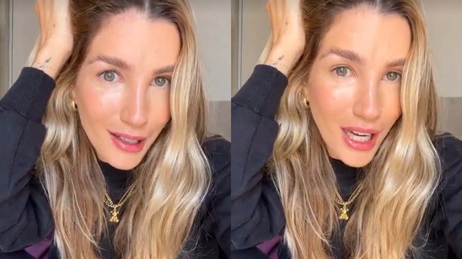 Ex-BBB Aline Gotschalg mostra curativo após retirar tumor