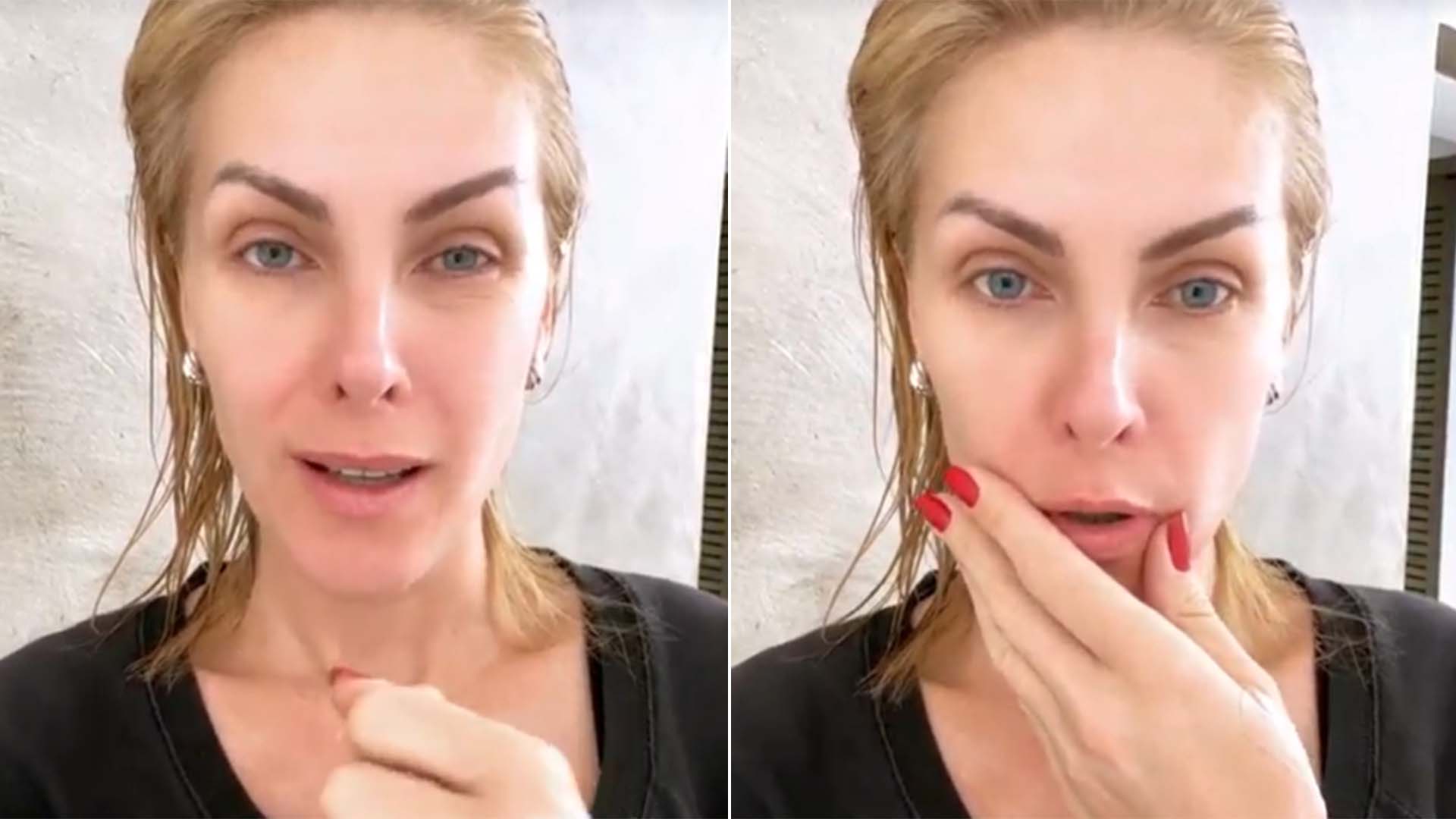 Ana Hickmann corta a mão ao sofrer acidente doméstico