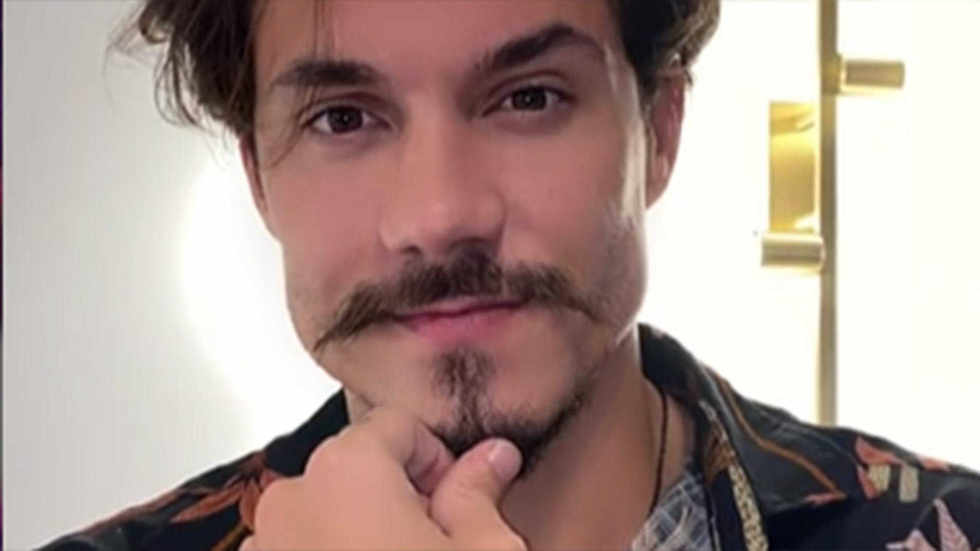 Ex-BBB Eliezer faz transplante de barba e cabelo